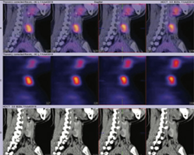 Endocrinology