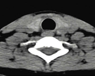 Endocrinology