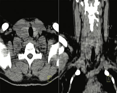 Endocrinology