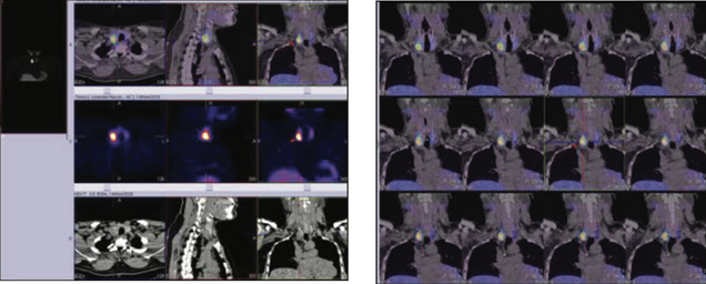 Case study - Endocrinology