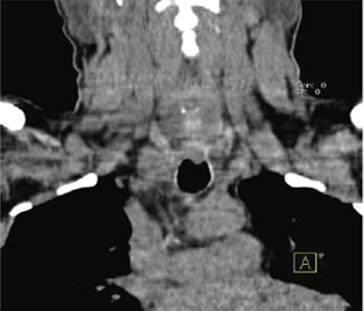 Case study-Endocrinology