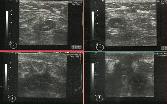 Breast Imaging