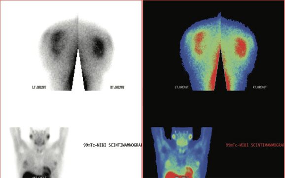 Breast Imaging