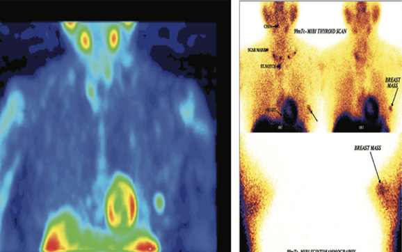 Breast Imaging