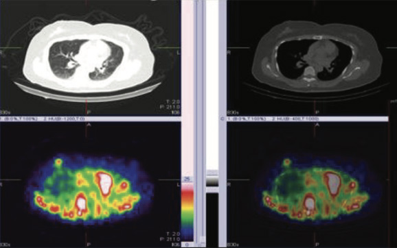 Breast Imaging