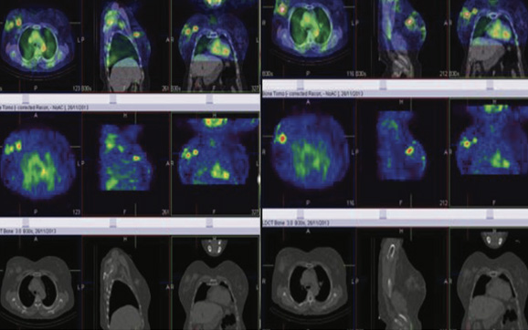 Breast Imaging