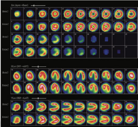 Cardiology