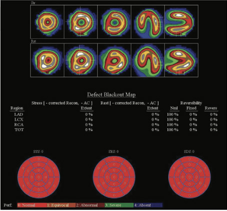 Cardiology