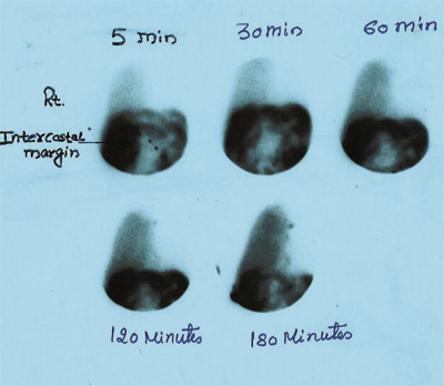 Gastroenterology