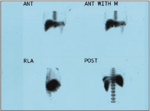 Gastroenterology