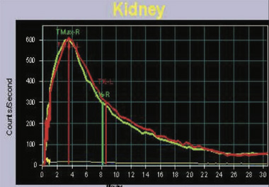 Nephro-Urology