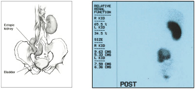 Nephro-Urology