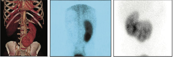 Nephro-Urology