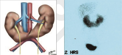 Nephro-Urology