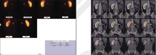 Nephro-Urology