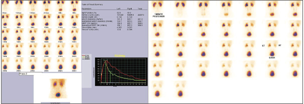 Nephro-Urology