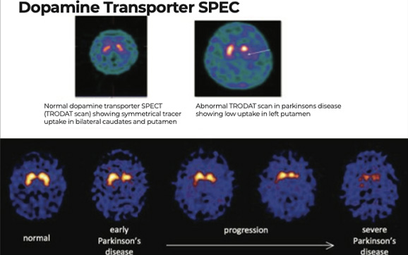 Neurology