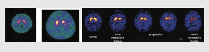 Neurology