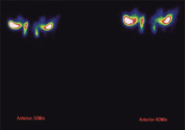 Ophthalmology