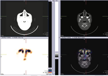 Ophthalmology