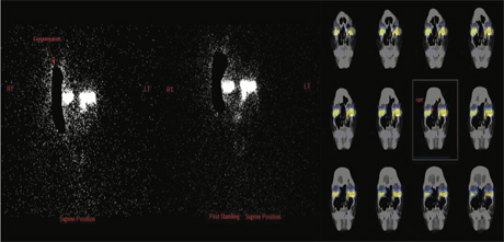 Ophthalmology