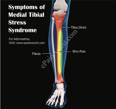 Orthopaedic