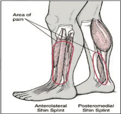 Orthopaedic