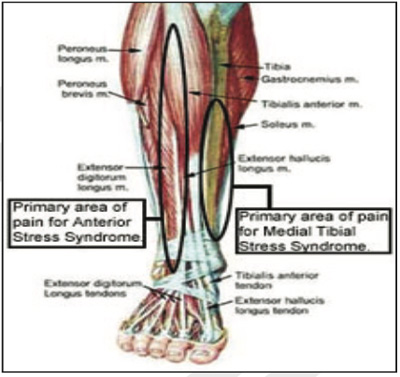 Orthopaedic