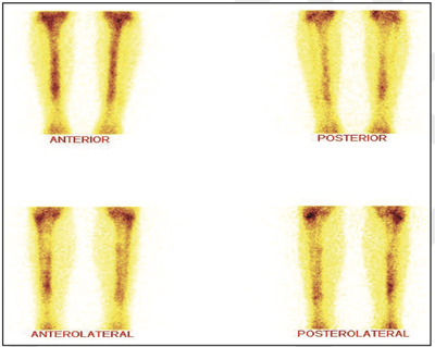 Orthopaedic