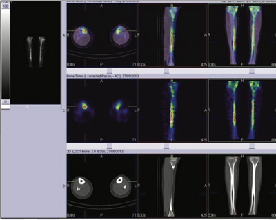 Orthopaedic